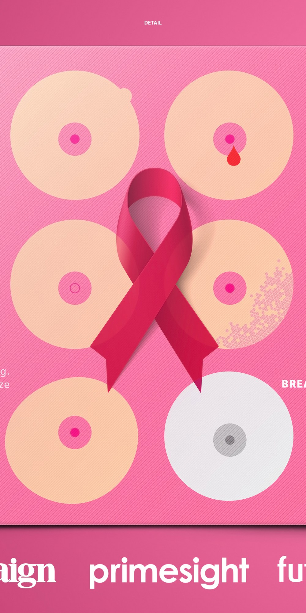 乳腺癌公益海报