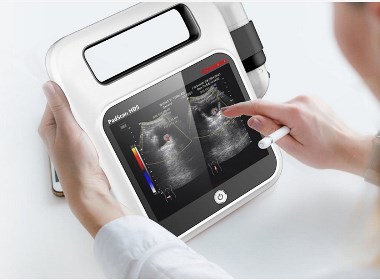 智加设计|便携式膀胱检测仪-获2019年红点奖